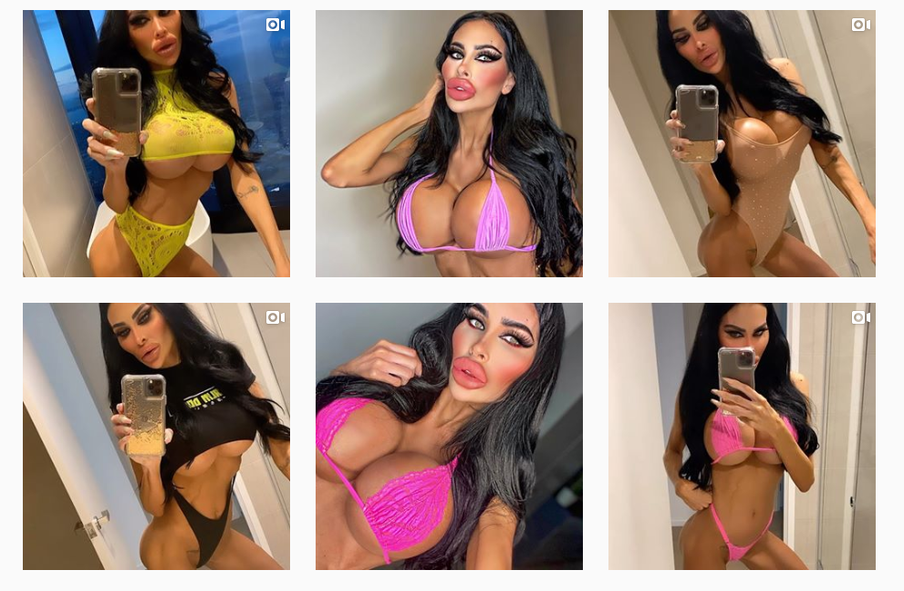 Потрошила 135.000 долари на операции , пет пати ги зголемила гpадите (ФОТО)