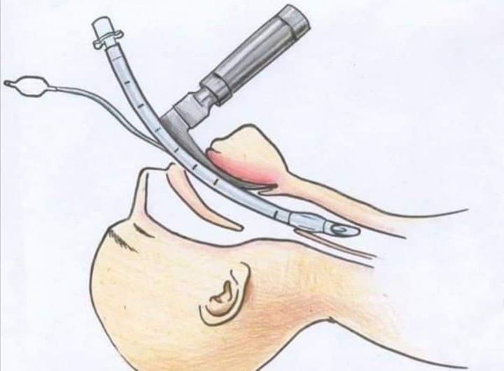 „За оние кои НЕ знаат што значи да се биде на РЕСПИРАТОР“