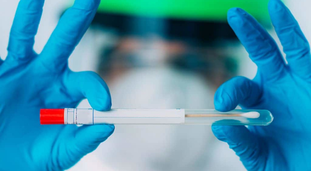 Дневна доза македонски експерти:„ПЦР тестот дава лажни резултати“