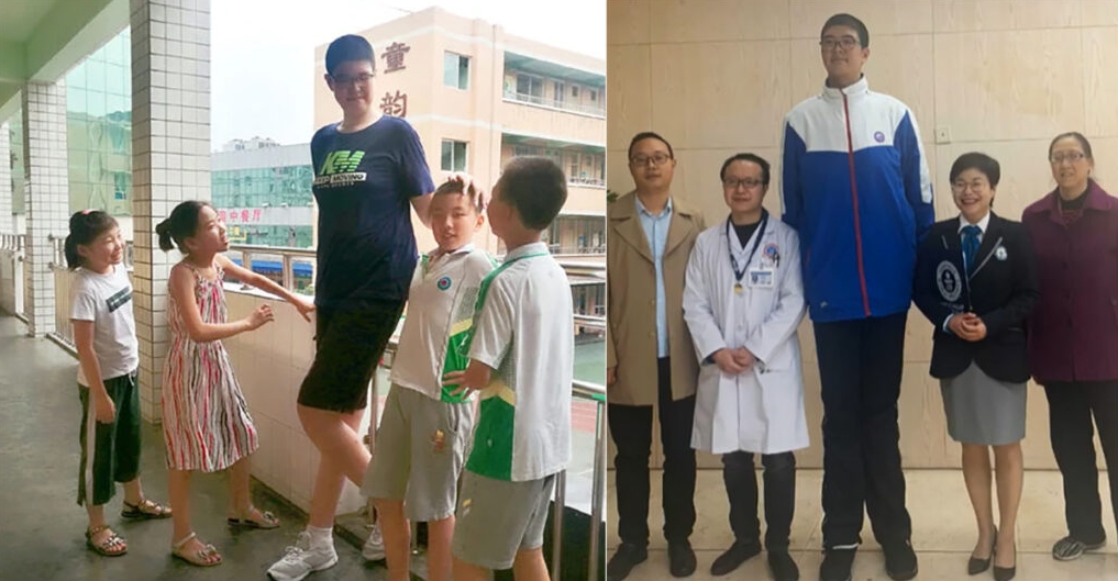 Дете-џин: Има само 14 години, а висок е 221 сантиметар