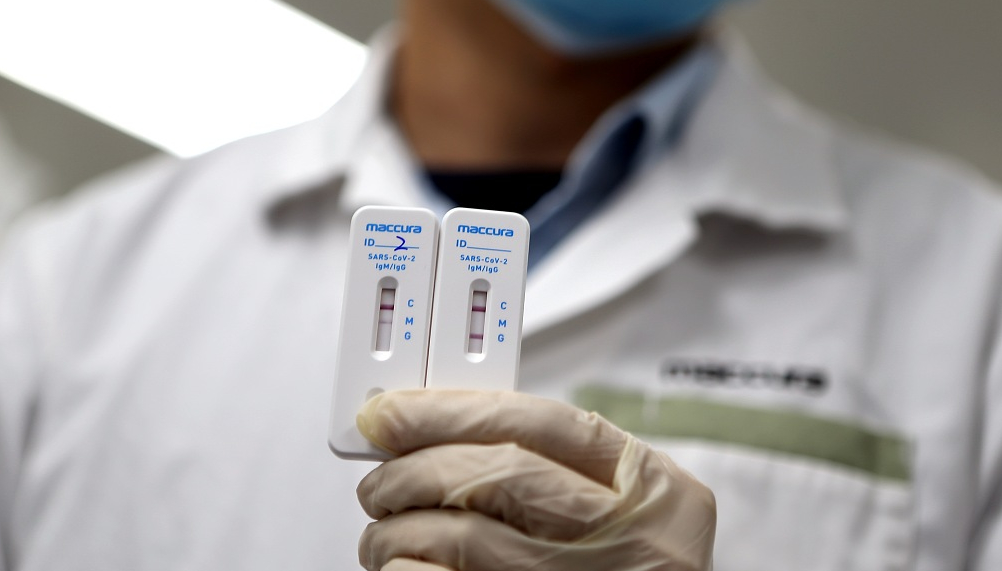 Ако сте тестирани и ви е потврден вирусот, ОБЈАВЕТЕ ГО ТОА! Чесно и одговорно!