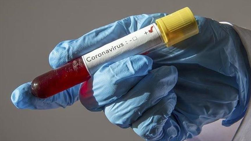 Уште 28 лица ја загубија битката со коронавирусот, најмладиот е 39 годишен