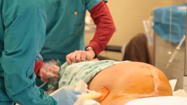 Скандал во битолска гинекологија – царски рез извршил невработен гинеколог