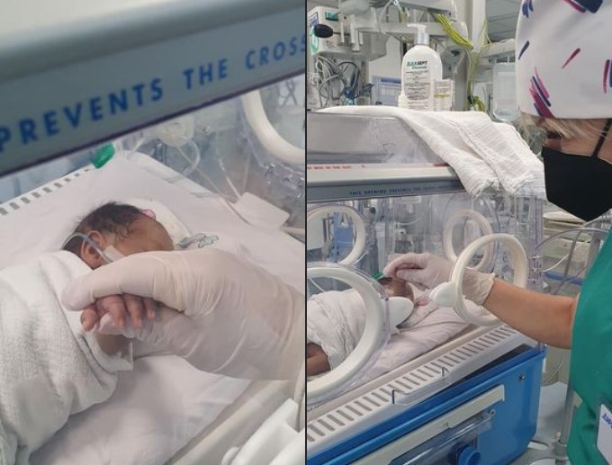 Девојче, родено со едвај 800 грама е вистински херој на одделението за Интензивна нега