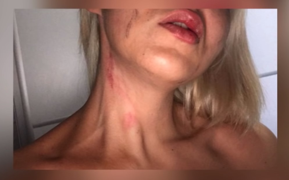 За „Јавна соба“ паника, за претепана и силувана девојка шест месеци се чека обвинение, сторителот на слобода!