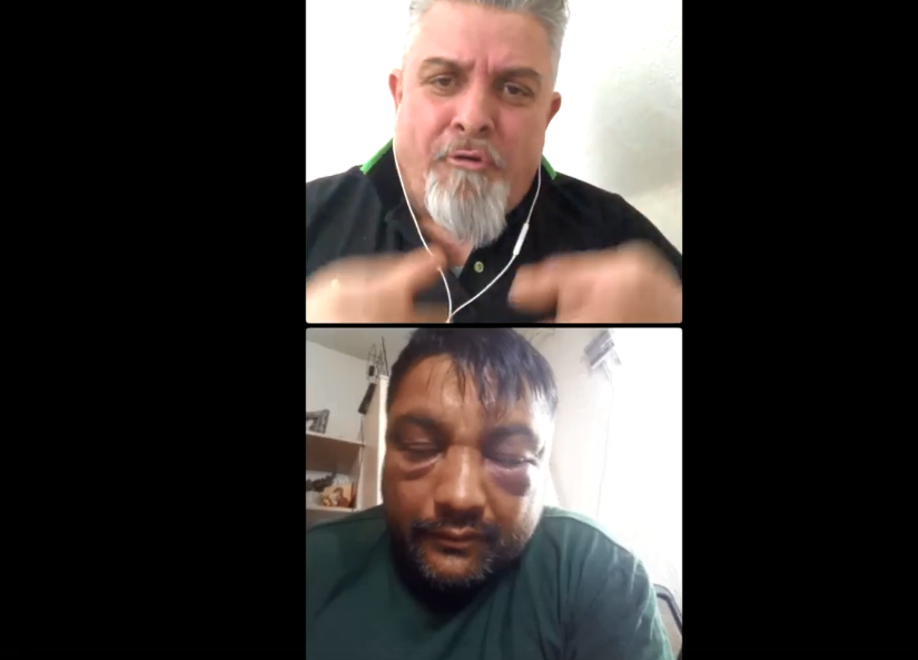 Игор раскажа како беше претепан во Струмица: Сакаа да ме прегазат и со возило (Видео)