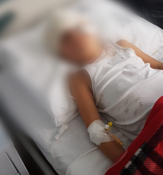 ИСКАСАНО 5-годишно дете од Тетово од кучиња, за серум за беснило пратени во Скопје ‼