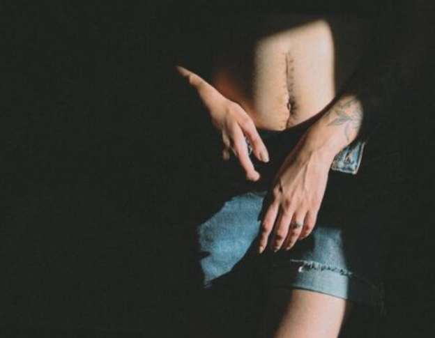 Ме чуваа со некроза, повраќав фекалии, докторката ме испрати во Скопје со: Ако не ја примат, не ми ја враќајте тука