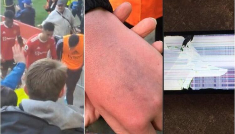 Роналдо удрил аутистично момче по раката, па му го скршил телефонот – сепак, имало и поголеми последици кои ги објави мајката (ВИДЕО)