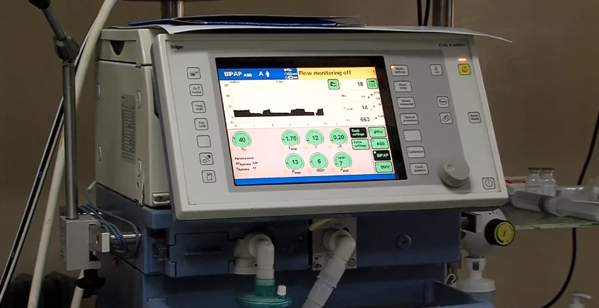 Трагедија: 11-годишно момче од Скопје почина на КАРИЛ, не го преживеа ударот од пречка од гол на екскурзија