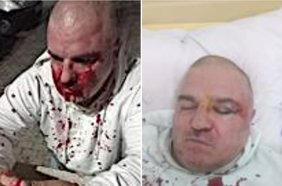 (Фото) Претепан новинарот Зоран Буревесник Божиновски