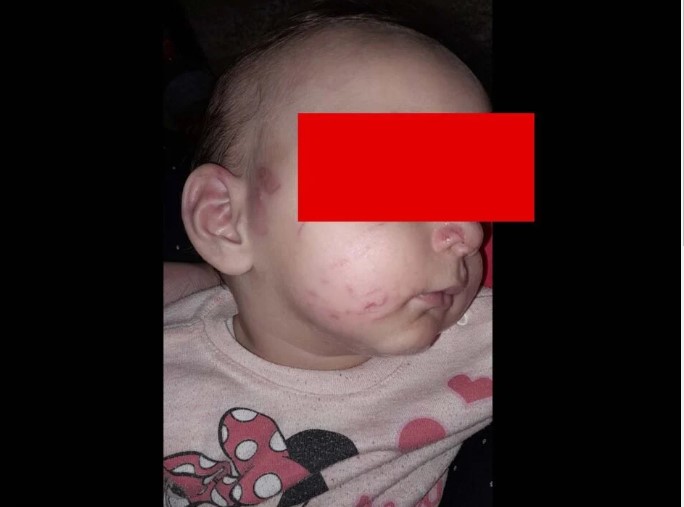 Како е повредено 10-месечното бебе во гевгелиската градинка?!