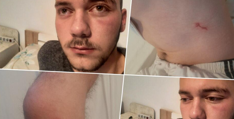 Нов напад врз младо момче во Косово, се враќало од божиќна литургија