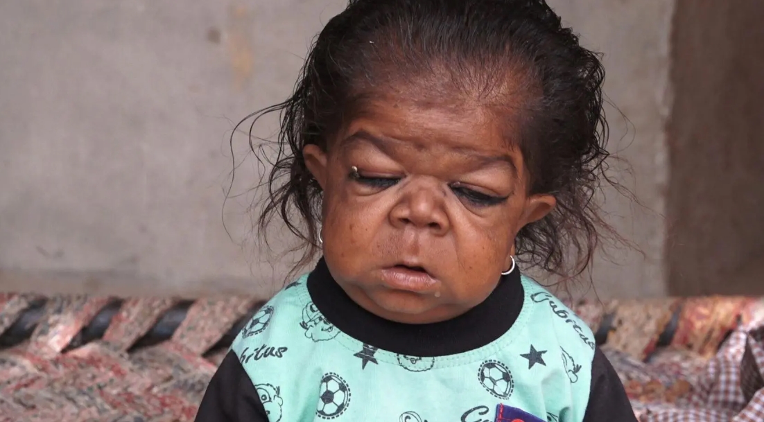 ФОТО+ВИДЕО: Заробен во тело на бебе – Има 27 години и 59 сантиметри, го сметаат за божество