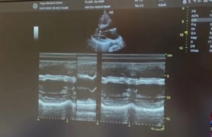 ДОКТОРИТЕ ВО ШОК: Млад Албанец е медицински феномен