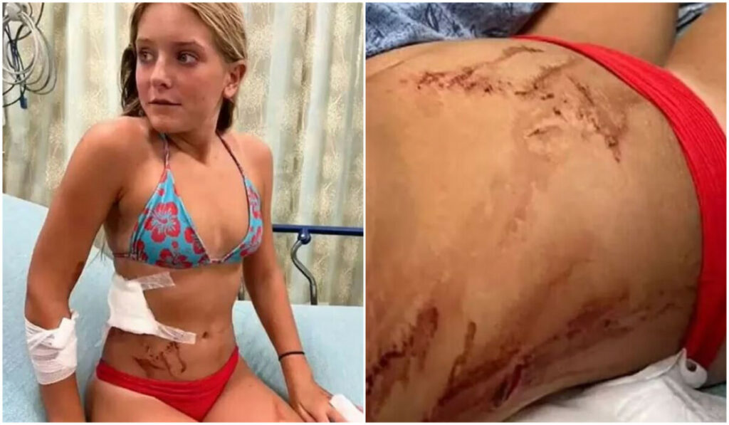 Храбро девојче од Флорида преживеа напад од ајкула, морскиот ѕвер доби тупаница (Видео)