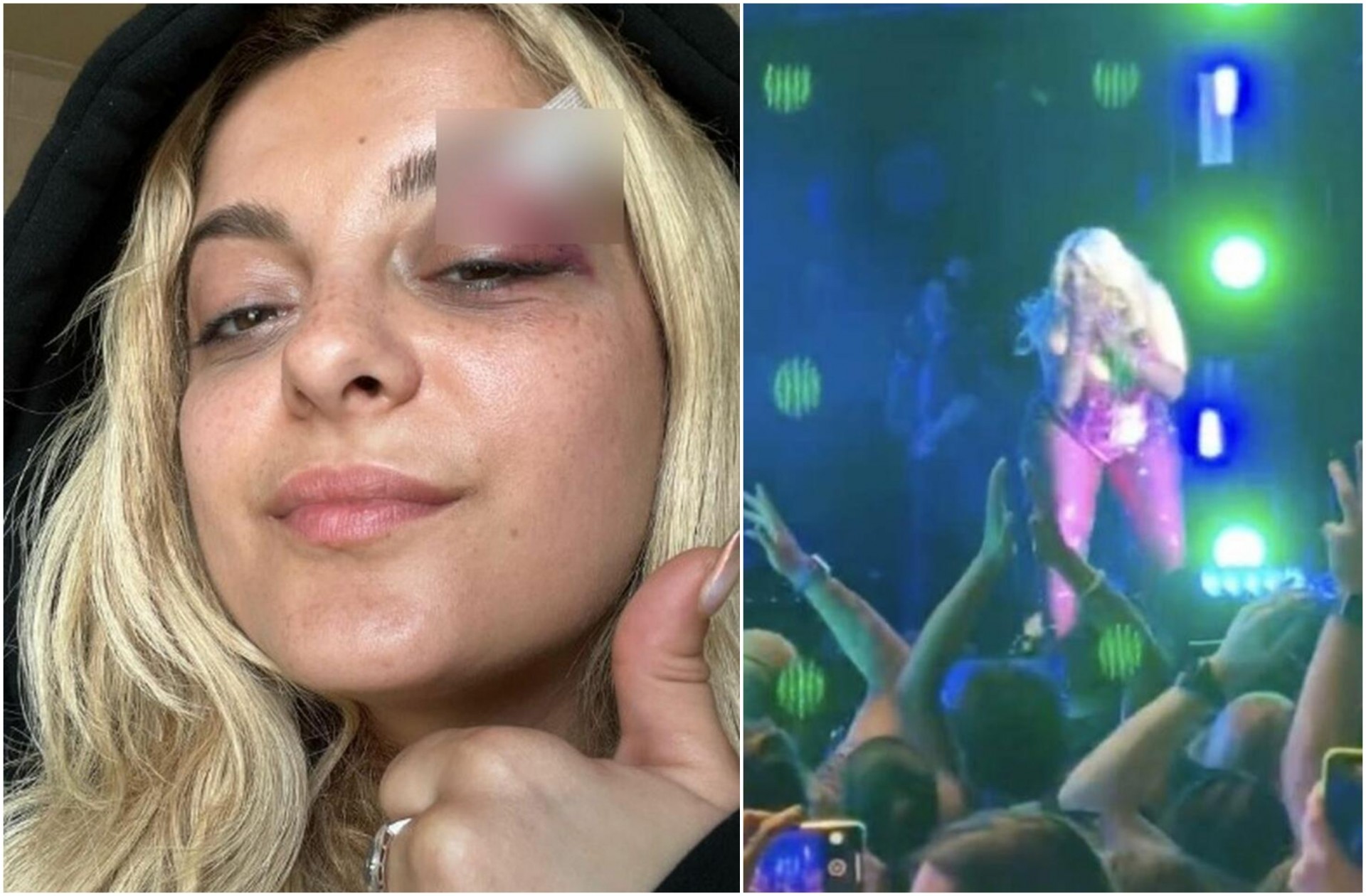 Бизарна причина: Момчето кое ја погоди албанската пејачка со мобилен откри што го натерало на тоа