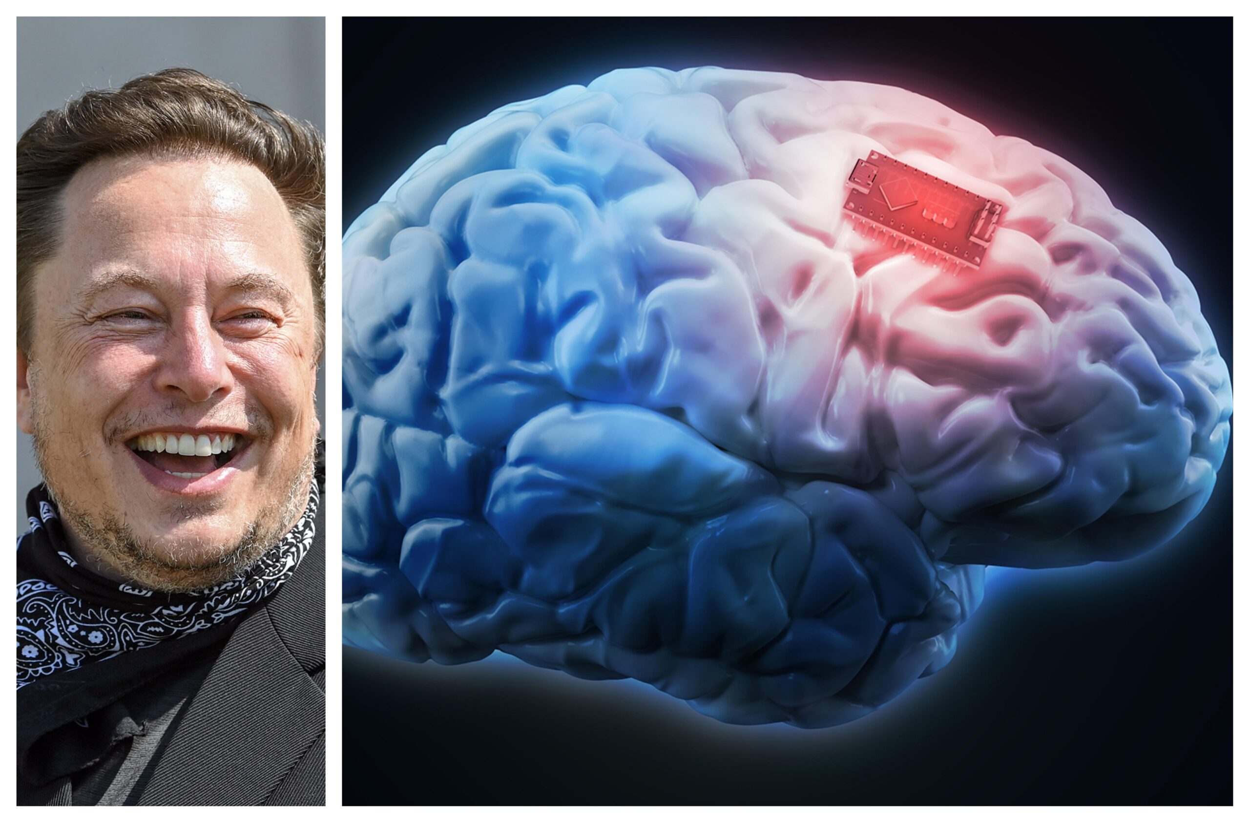 Маск оваа година ќе почне со имплантација на мозочен чип