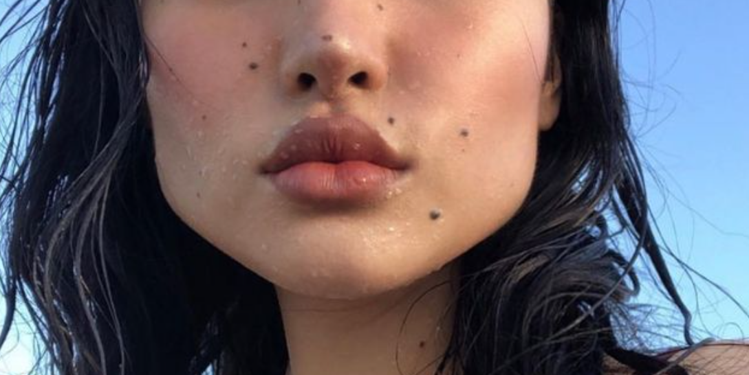 Октријте што значи бенката што ја имате на вашето лице или тело