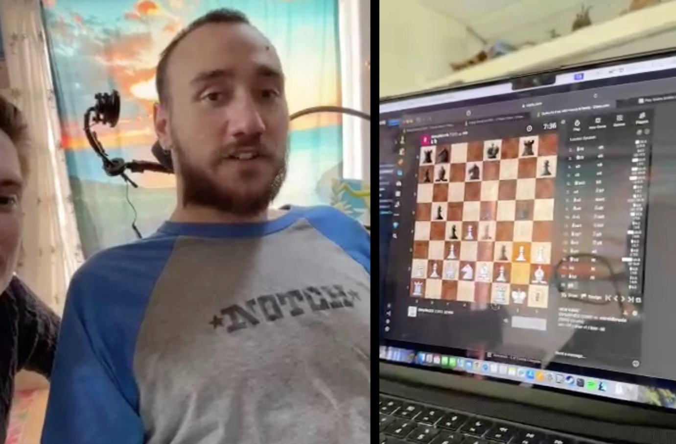 Има чип во мозокот кој му ги чита мислите – благодарение на Маск