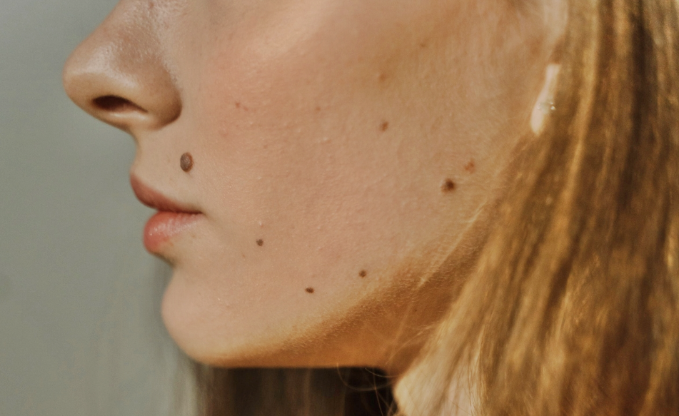 Имате бенка на која растат влакненца? Еве што значи тоа