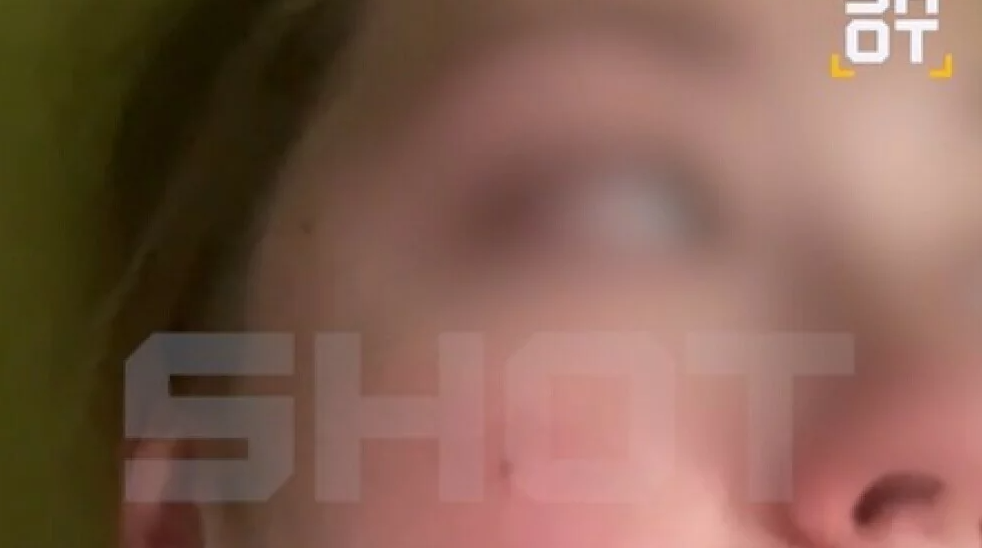 Мистериозна зараза во Русија: Симптоми слични на ковид, но заболените искашлуваат крв?