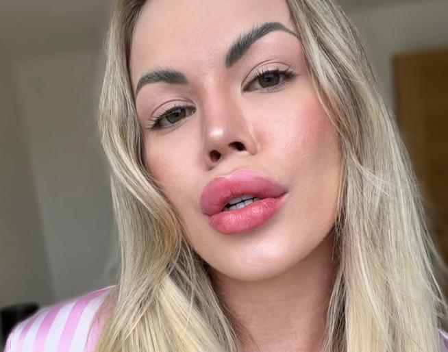 “Потрошив 50.000 долари за да изгледам како жена на фудбалер” (ФОТО)