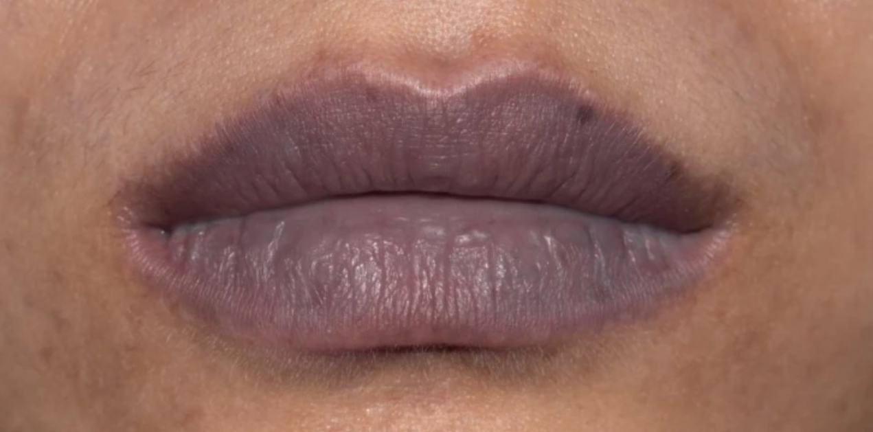 Сини или сиви усни: Еве кога итно мора да посетите доктор