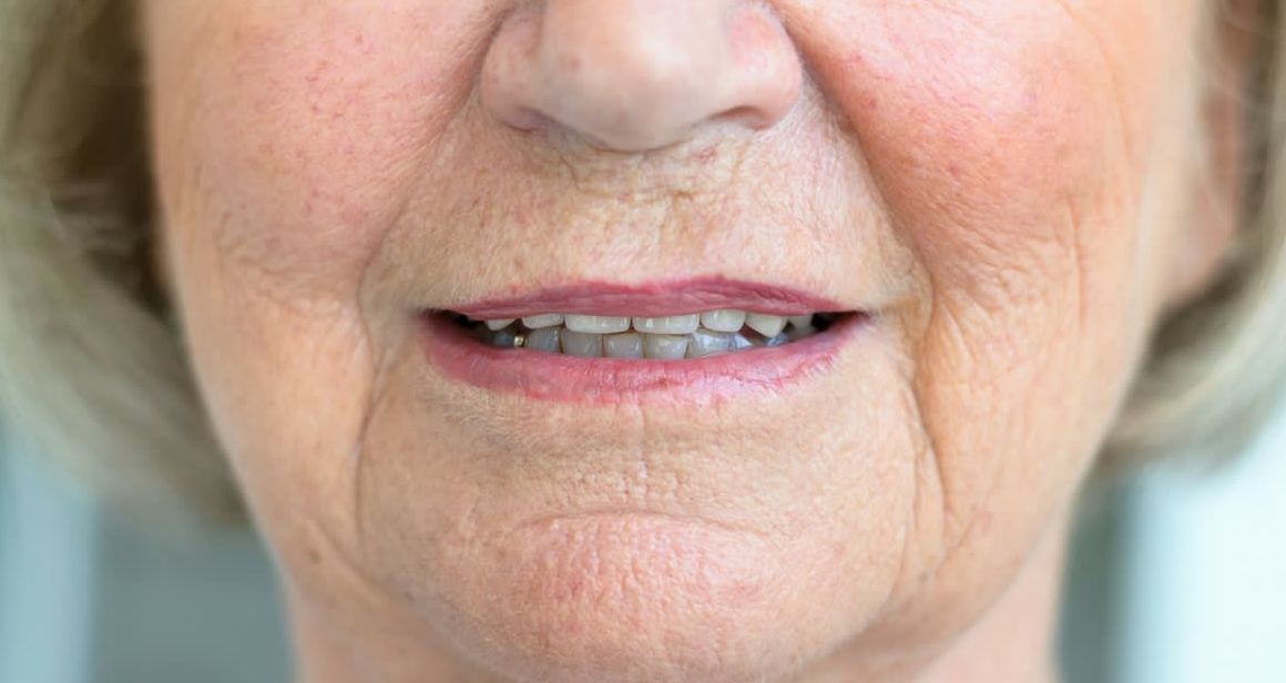 “Имам 62 години и совршени заби, никогаш не сум посетил стоматолог, но оваа секојдневна навика никогаш не ја прескокнувам”