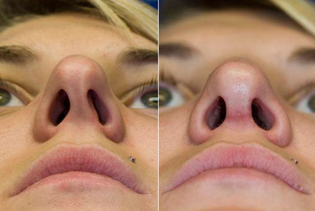 80% од луѓето го имаат овој проблем, а не знаат дека се решава многу едноставно