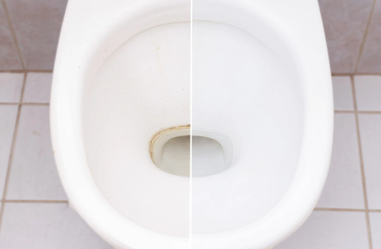 Пет годишни флеки исчезнаа за пет минути: “Ставив само една состојка, резултатите ги видов за само неколку минути”