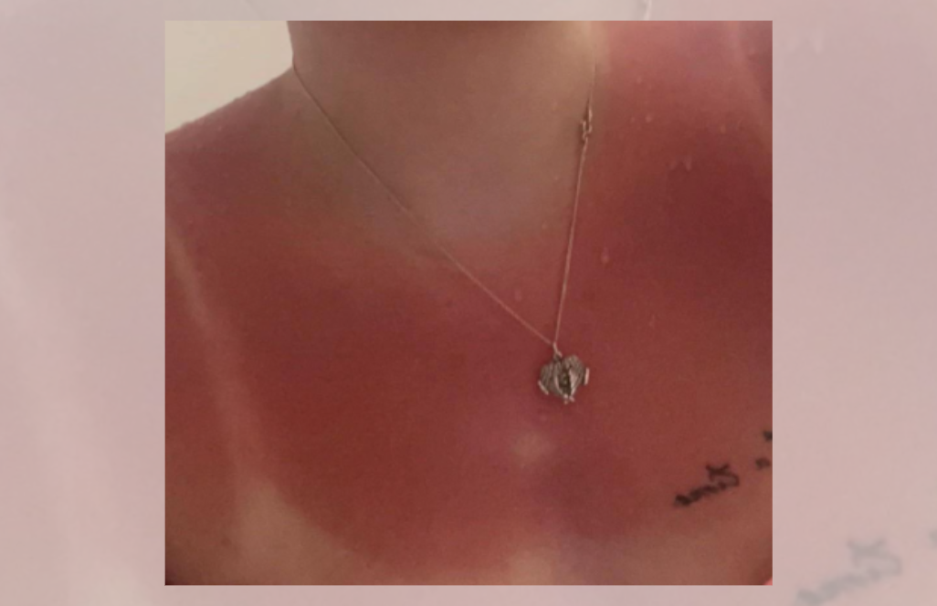 Девојка сподели нов начин на сончање, докторите алармираат: “Ова може да доведе до рак и прерана смрт”