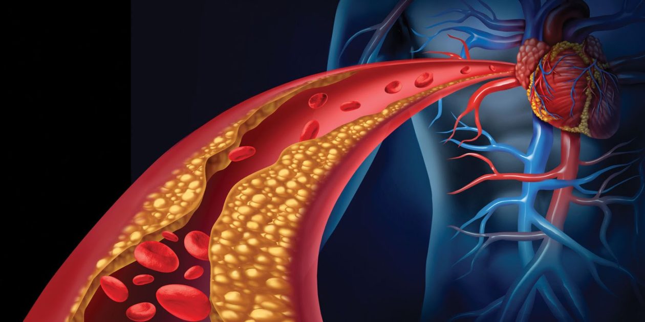 Како да го препознаете високиот холестерол и како успешно да го намалите? Ова е најважно