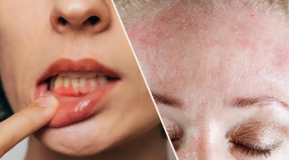 Бидете внимателни: Овие знаци покажуваат дека вашето тело има огромен недостаток на витамин Ц