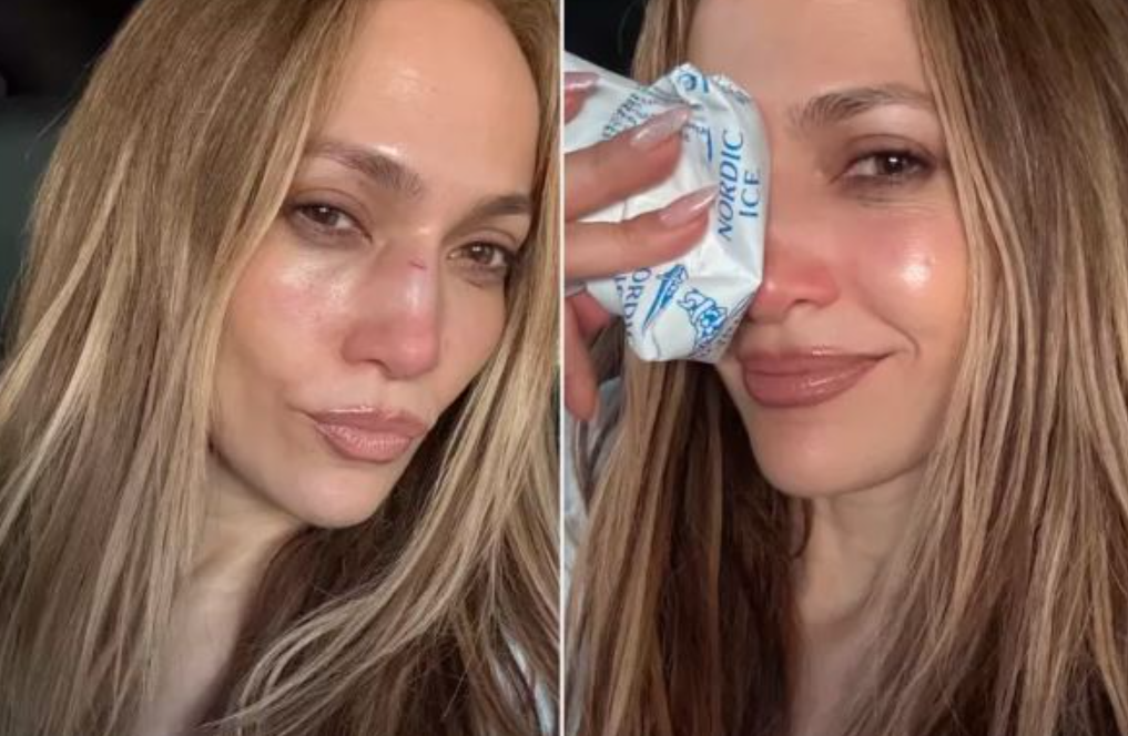 Џенифер Лопез доживеа несреќа пред големиот настан: Заврши со повреди на лицето [ФОТО]