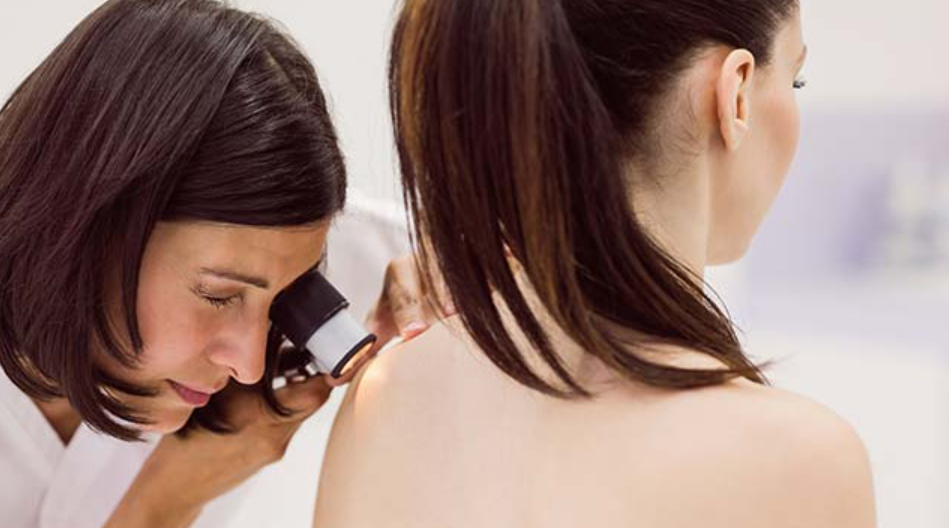 Дерматолог со важно предупредување за летото: “Доколку забележите нешто вакво на кожата, веднаш одете на лекар”