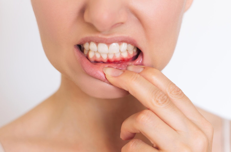 Лекарите предупредуваат на ран симптом на остеопороза што често се занемарува