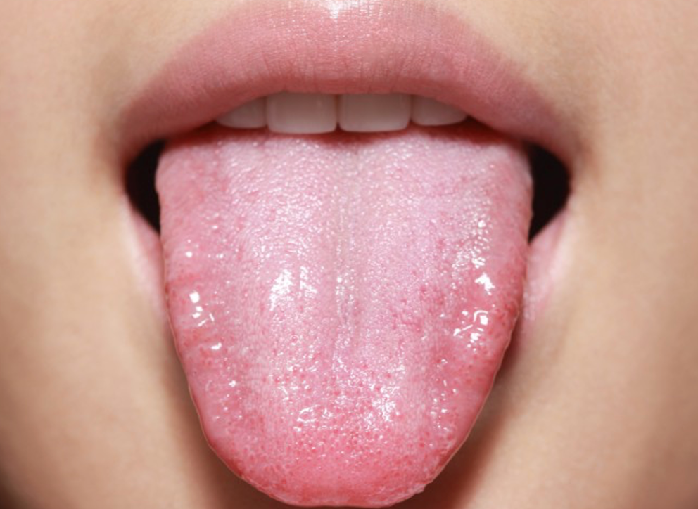 Ако ги имате овие промени во устата – веднаш посетете лекар: Може да бидат симптом на рак