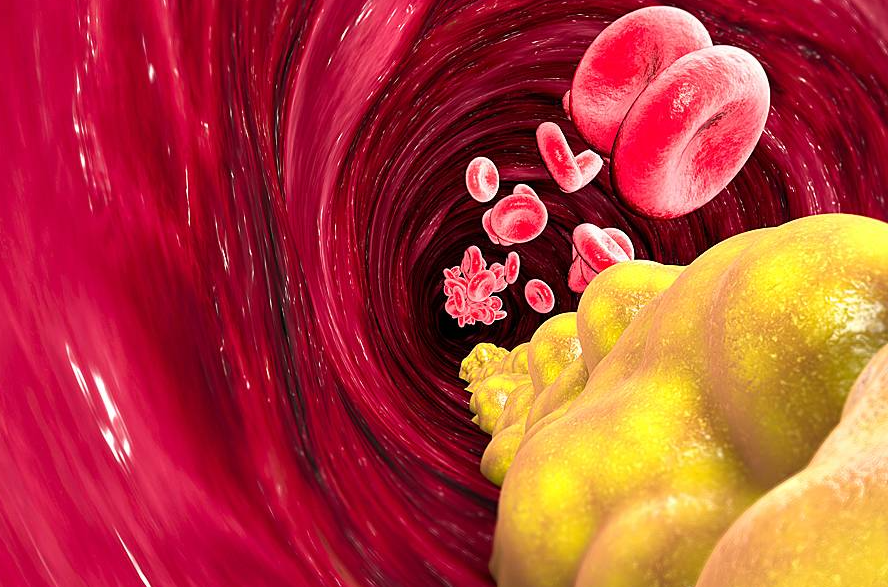 Три утрински навики кои ќе ви помогнат да го регулирате холестеролот