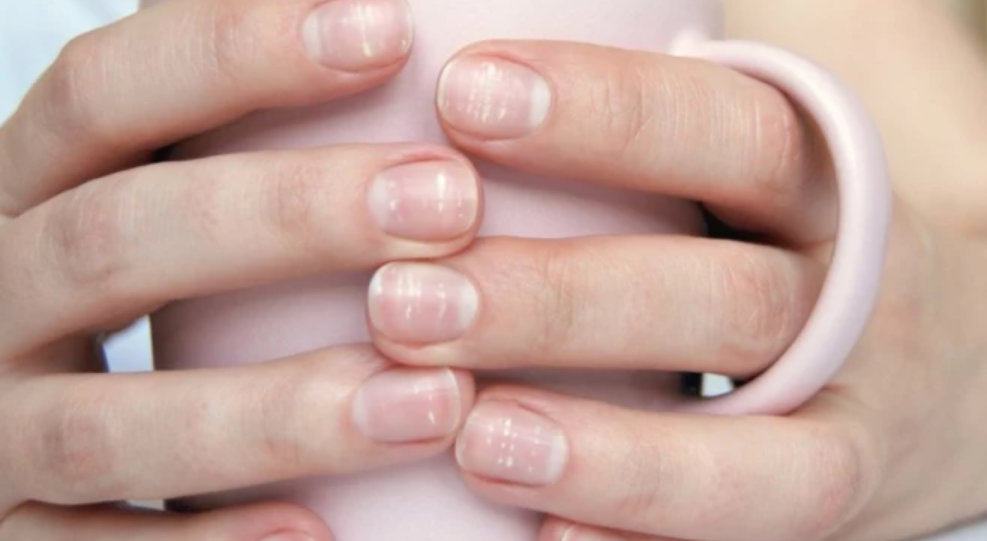 Еден знак на ноктите може да открие опасна срцева болест